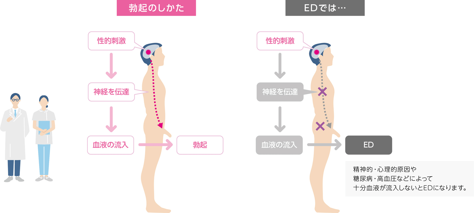 EDの原因は？